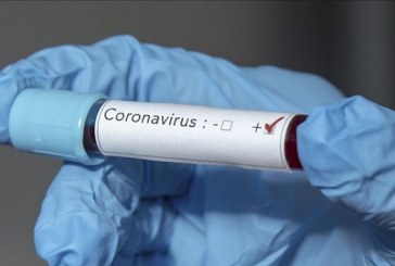 Confirman 2 nuevas muertes por COVID-19 y 34 nuevos casos positivos en Honduras