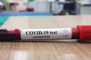 Casos de COVID-19 en Honduras se incrementan a 562 infectados