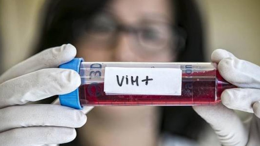 China desarrolla primer fármaco contra el VIH clínicamente seguro