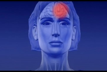 Sugerencias para prevenir y controlar los dolores de cabeza, desde migrañas hasta cefaleas