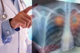 La inteligencia artificial aprende a identificar con precisión el cáncer
