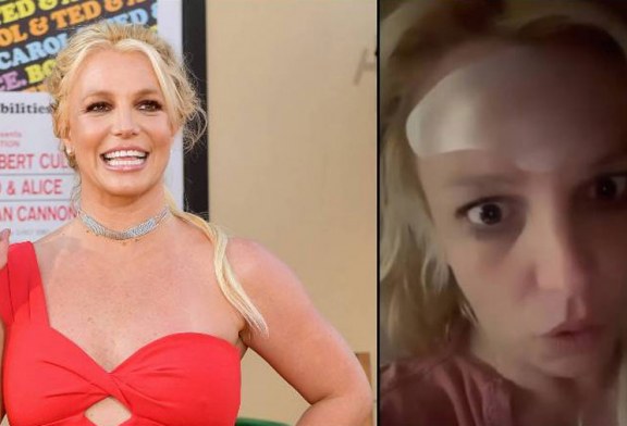 Britney Spears revela que el bótox le destrozó el rostro