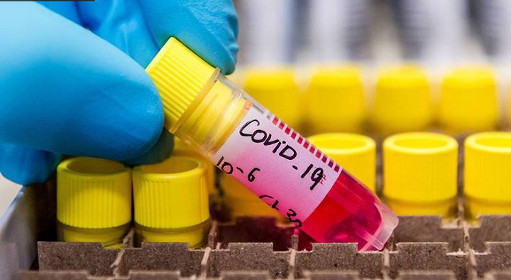 Se eleva a 95 los casos positivos de coronavirus en Honduras