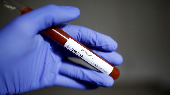 Farmacéutica española anuncia tener listo un medicamento para probarlo contra el coronavirus