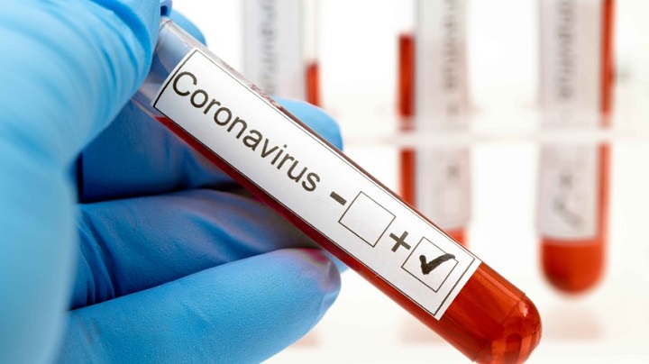 La cifra de personas contagiadas por coronavirus sube a 36 en Honduras