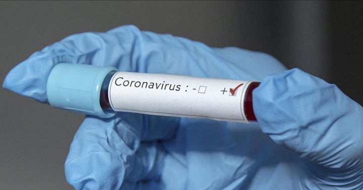 Confirman 2 nuevas muertes por coronavirus y 34 nuevos casos positivos en Honduras