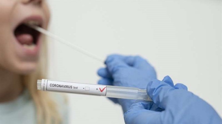 Comienzan a aplicar pruebas rápidas para detectar portadores asintomáticos de coronavirus en Cortés