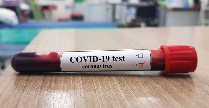 Casos de COVID-19 en Honduras se incrementan a 562 infectados