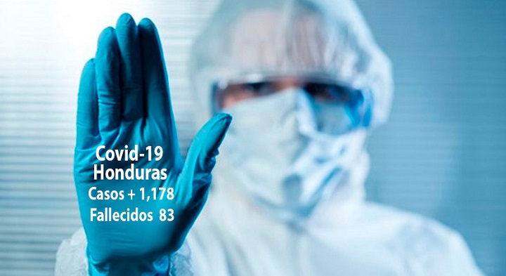 Aumenta a 1,178 casos de coronavirus en Honduras con los 123 contagios de las últimas 24 horas