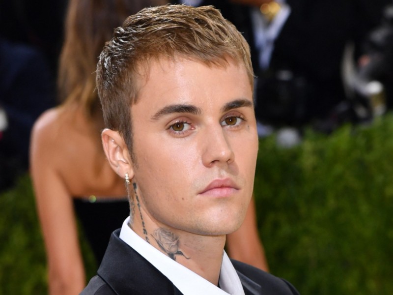 Justin Bieber informa que tiene parálisis facial, 