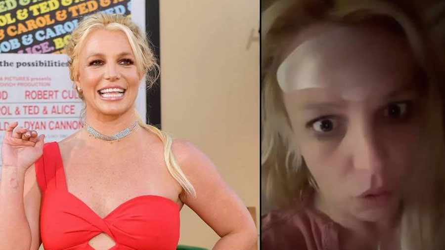 Britney Spears revela que el bótox le destrozó el rostro