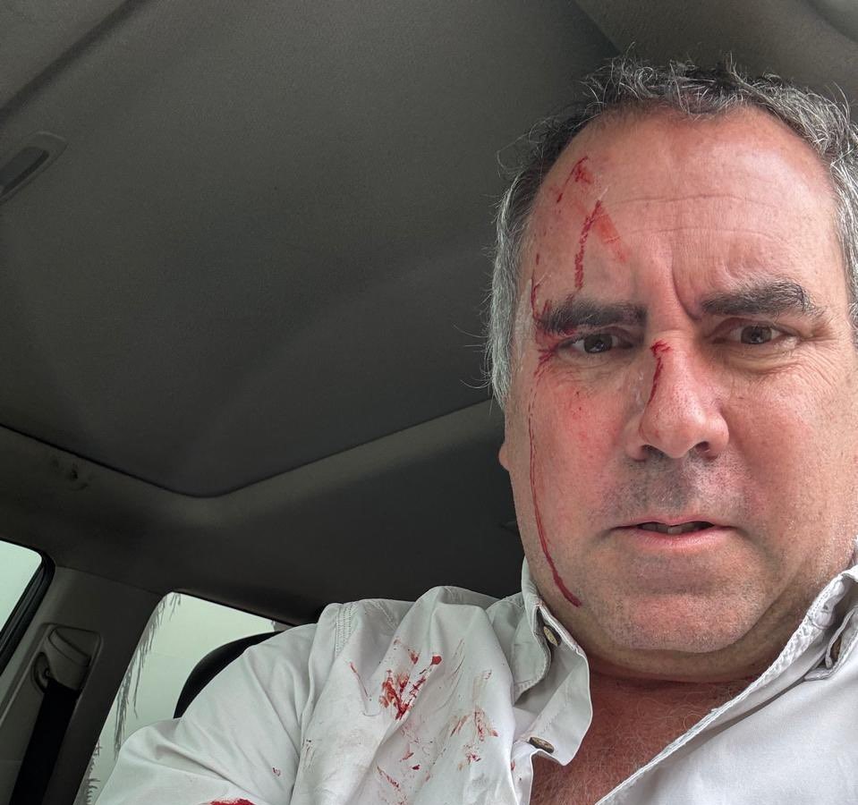 Un candidato presidencial de Perú sobrevive a un atentado tras ser tiroteado en su vehículo